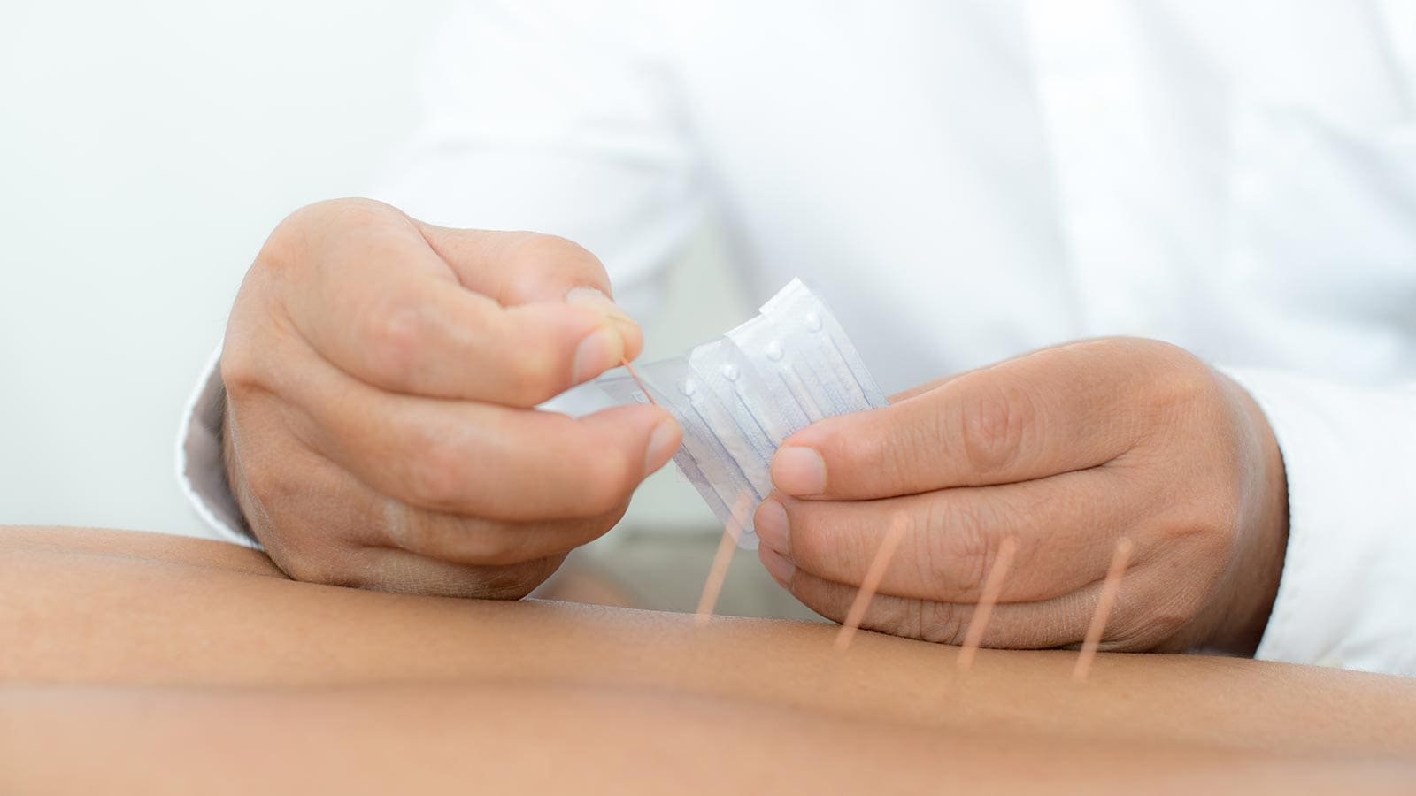 What to Expect at Your First Acupuncture Visit in Langley