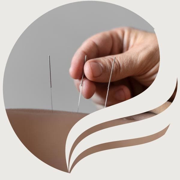 Acupuncture clinic near you in Langley